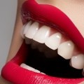 Co powinieneś wiedzieć o protezach i implantach zębów? - implanty zębów proteza koszt cena implanty zębów kraków porcelanowe